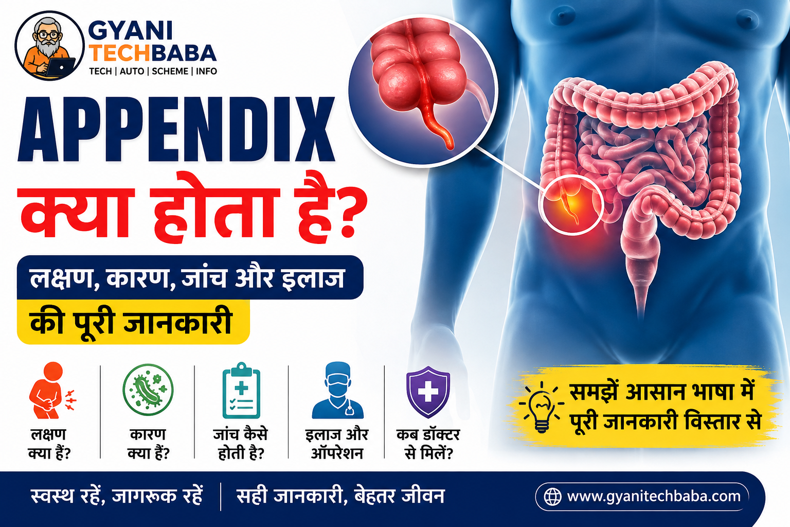 Appendix Kya Hota Hai